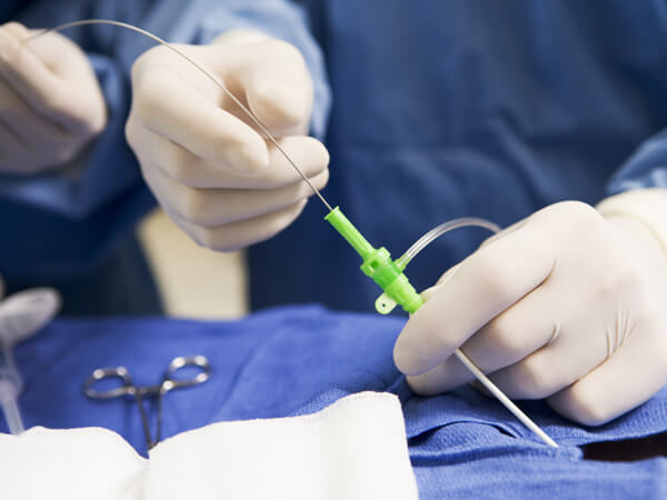 Interventional Pediatric Cardiology