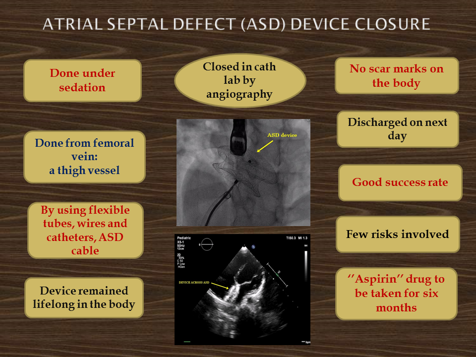 Treatment of Atrial Septal Defect (ASD)